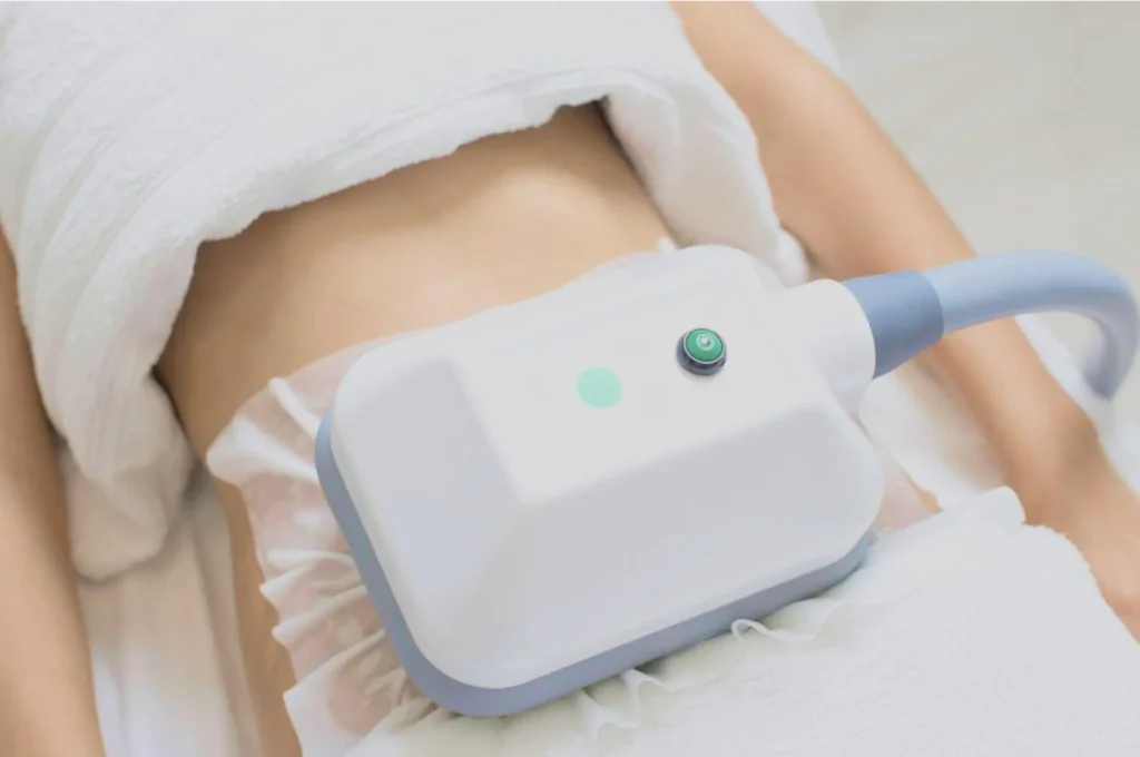 How Fat Freezing and HIFU Work Together? 3 advantages to combining Fat Freezing and HIFU Brackley