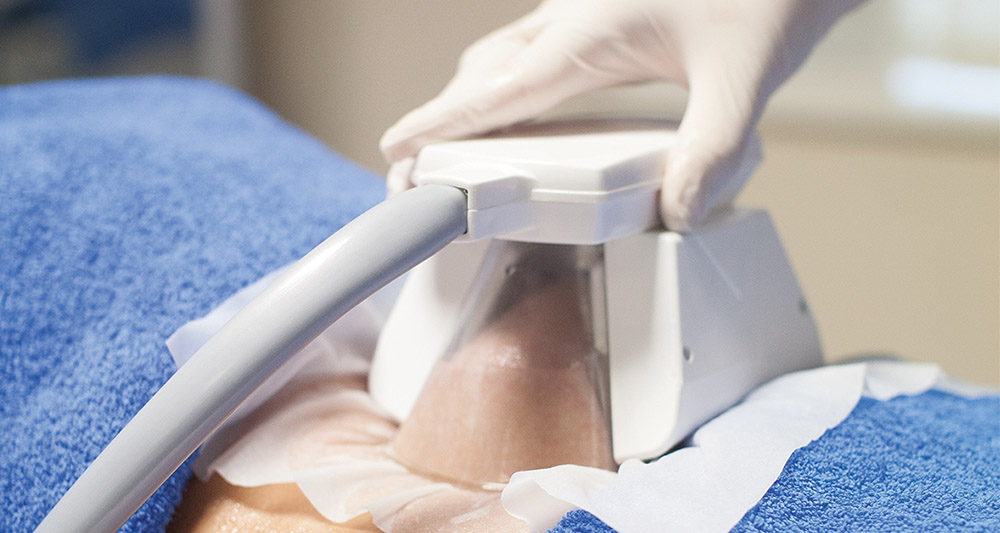 How Fat Freezing and HIFU Work Together? 2 Multiple Areas in One Session HIFU and Fat Freezing Brackley