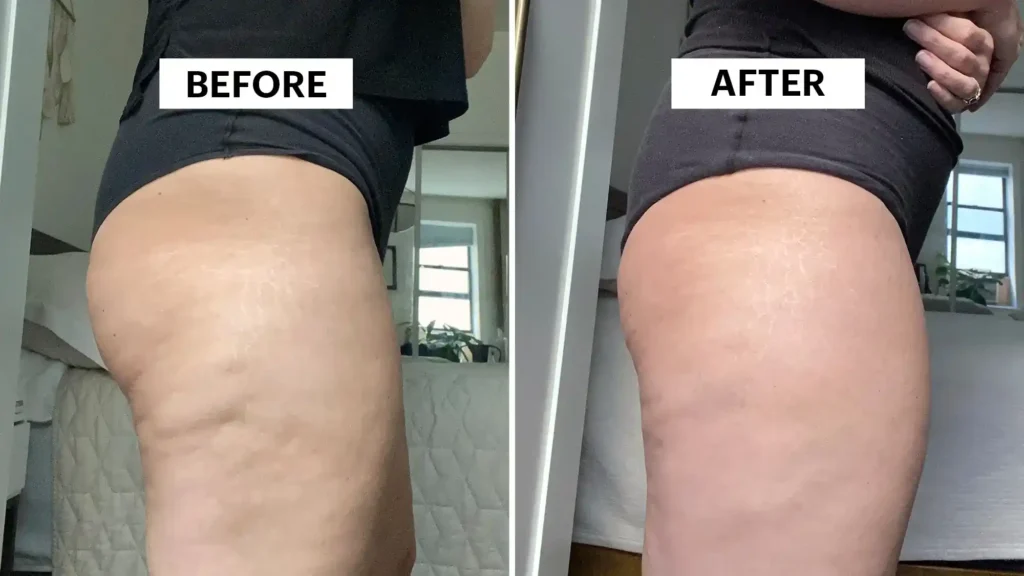 Sculpting Your Bum: Can Toning Exercises Really Reduce Cellulite? 1 Do Toning Exercise Brackley Really Tackle Cellulite?