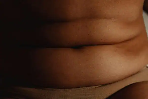The Hidden Connection: How Stress Shapes Your Fitness and Body Composition 3 image of what stress can do on the stomach area and how Lipo 360 Brackley can help to change your body shape.